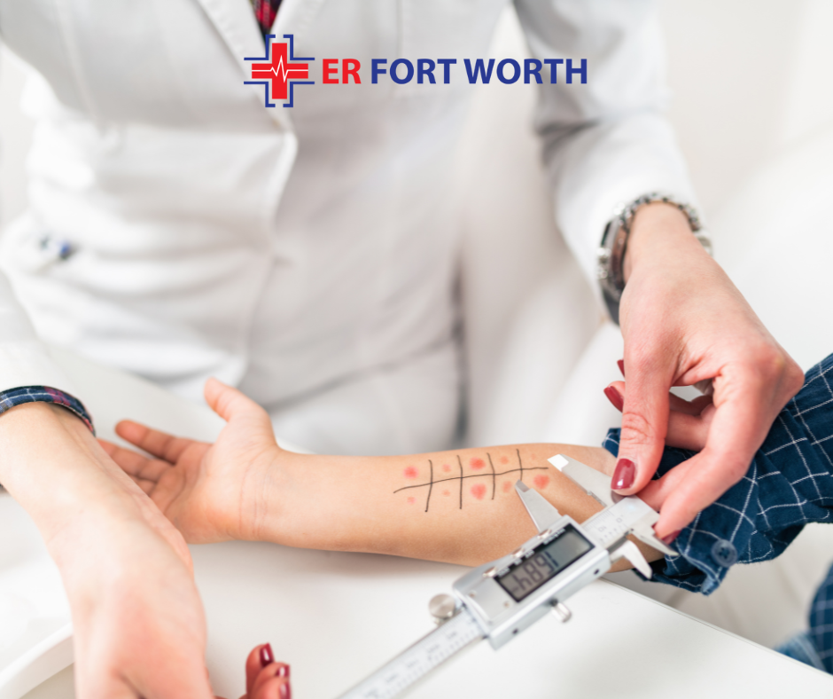 ER of Fort Worth for Allergic Reactions Treatment