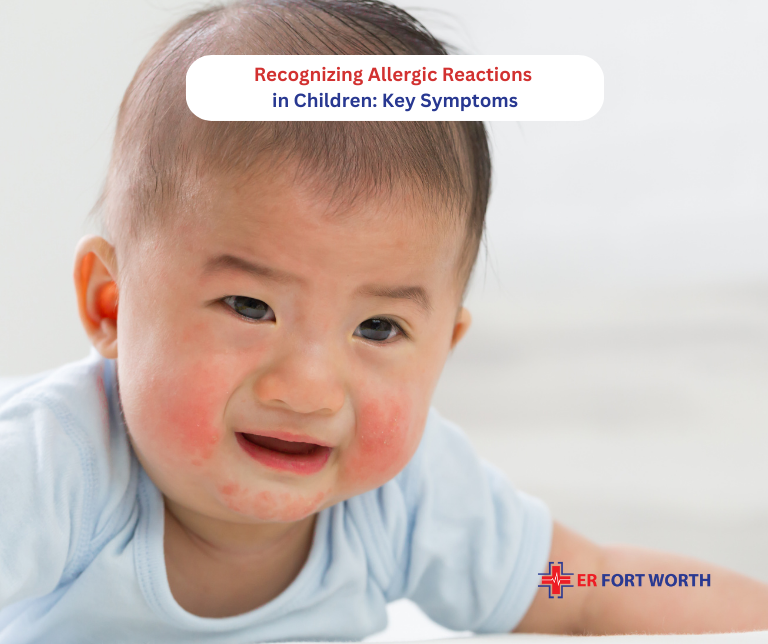 Recognizing Allergic Reactions in Children Key Symptoms - ER of Fort Worth