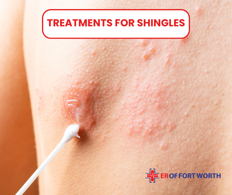 Shingles What Does It Look Like Signs Causes Treatment