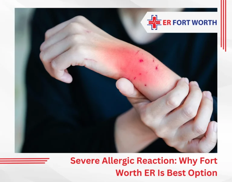 Severe Allergic Reaction Why Fort Worth ER Is Best Option