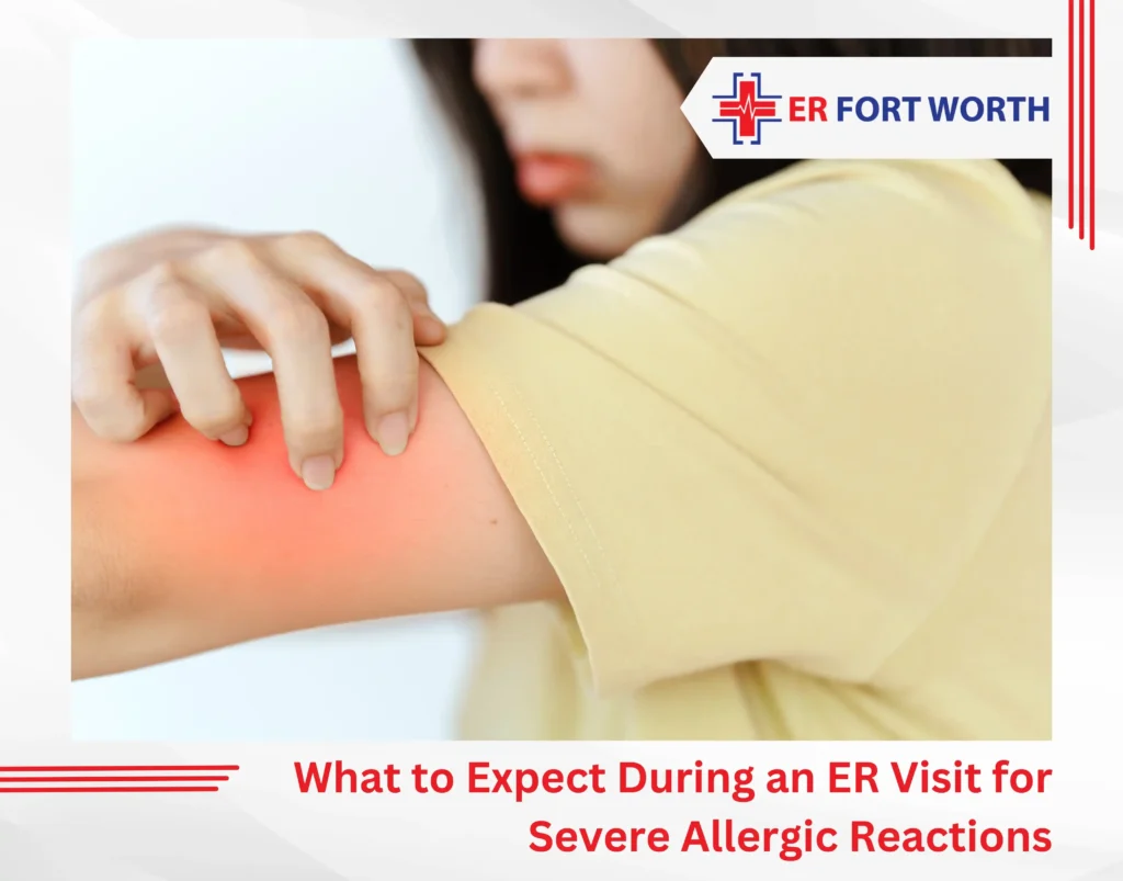 What to Expect During an ER Visit for Severe Allergic Reactions