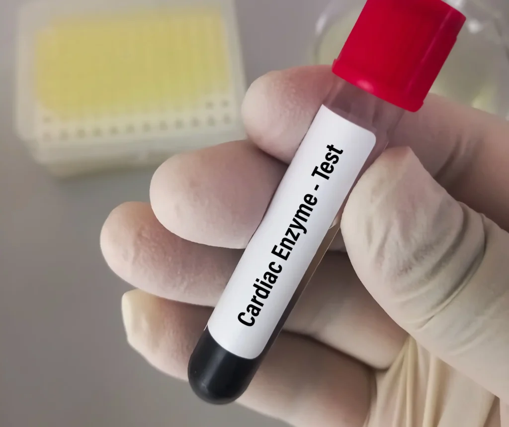 Cardiac Enzyme Test