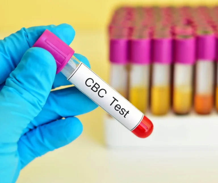 Complete Blood Count CBC scaled