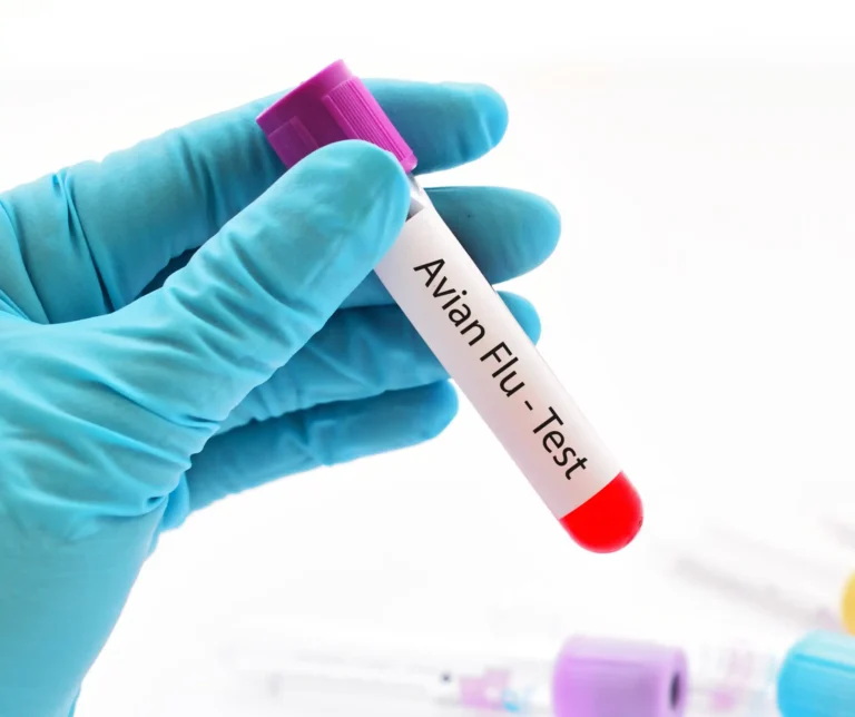 Flu Test scaled