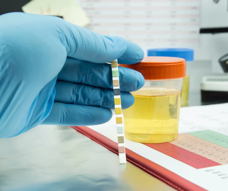 Urine Tests scaled