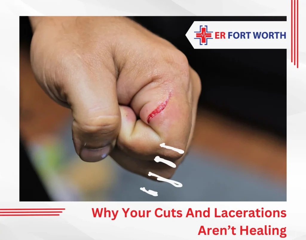 Why Your Cuts And Lacerations Aren’t Healing