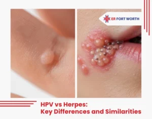 HPV vs Herpes