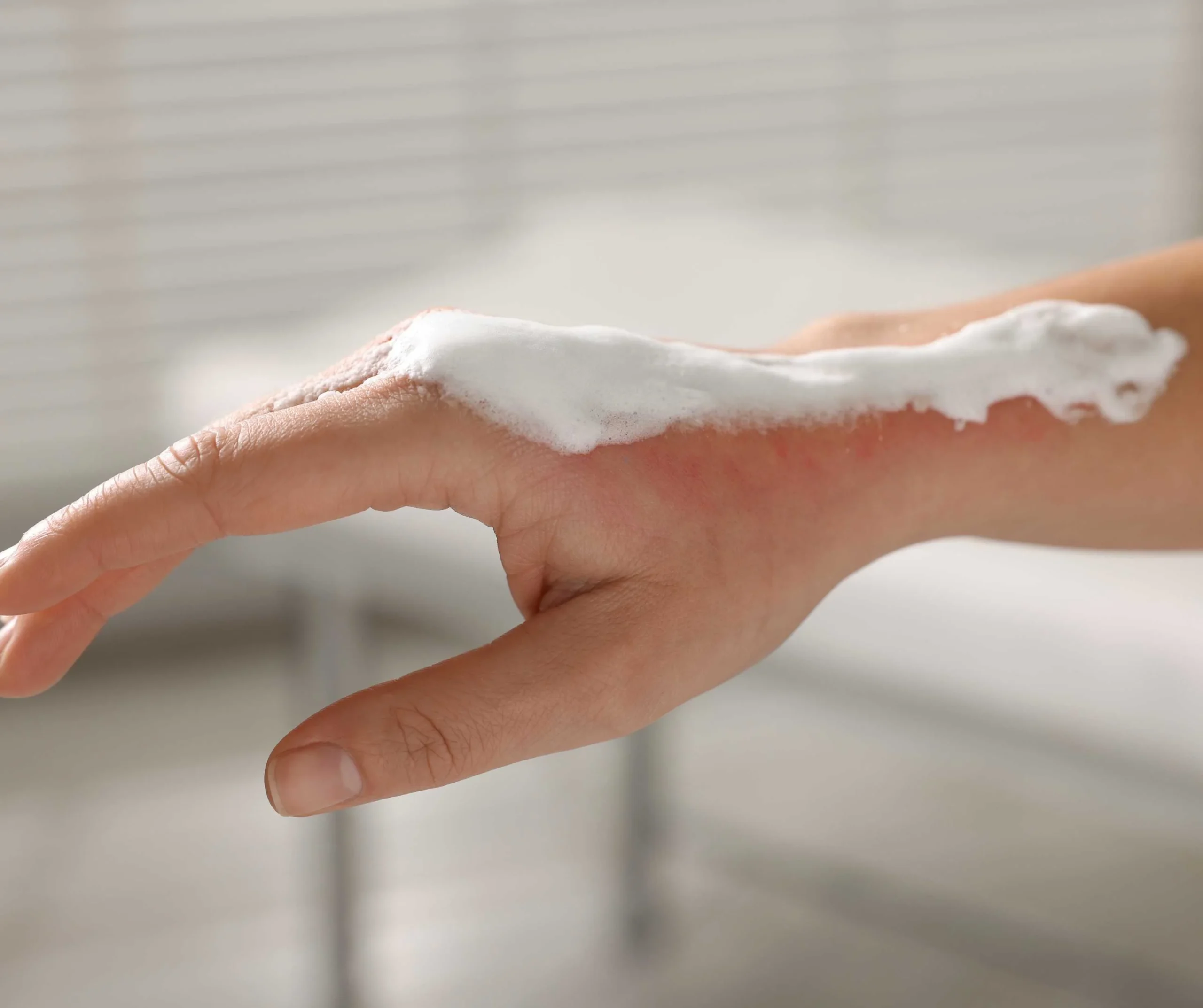 Immediate Pain Management