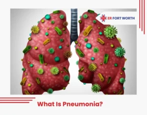 What is Pneumonia