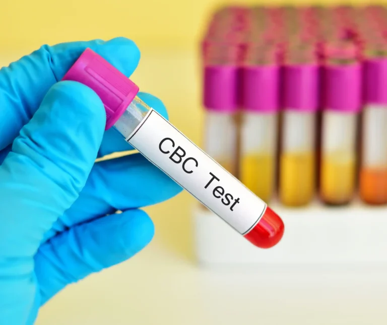 Complete Blood Count (CBC)