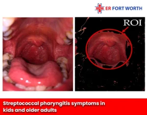 Streptococcal pharyngitis symptoms in kids and older adults