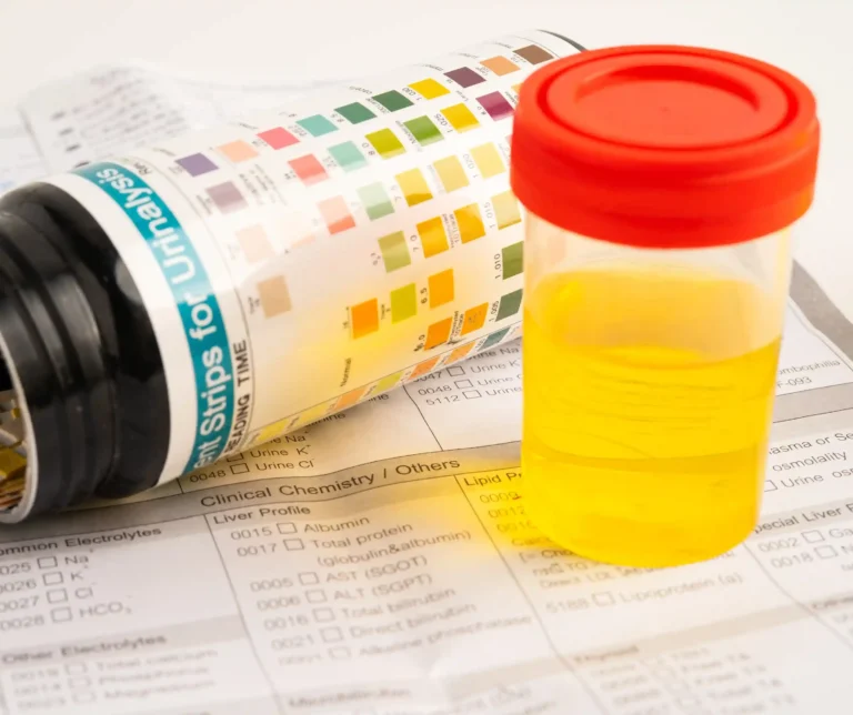 Urinalysis