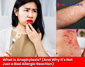 What Is Anaphylaxis (And Why It's Not Just a Bad Allergic Reaction)