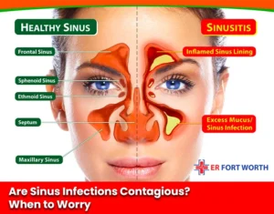 Are Sinus Infections Contagious When to Worry?