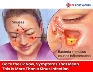 Go to the ER Now, Symptoms That Mean This Is More Than a Sinus Infection