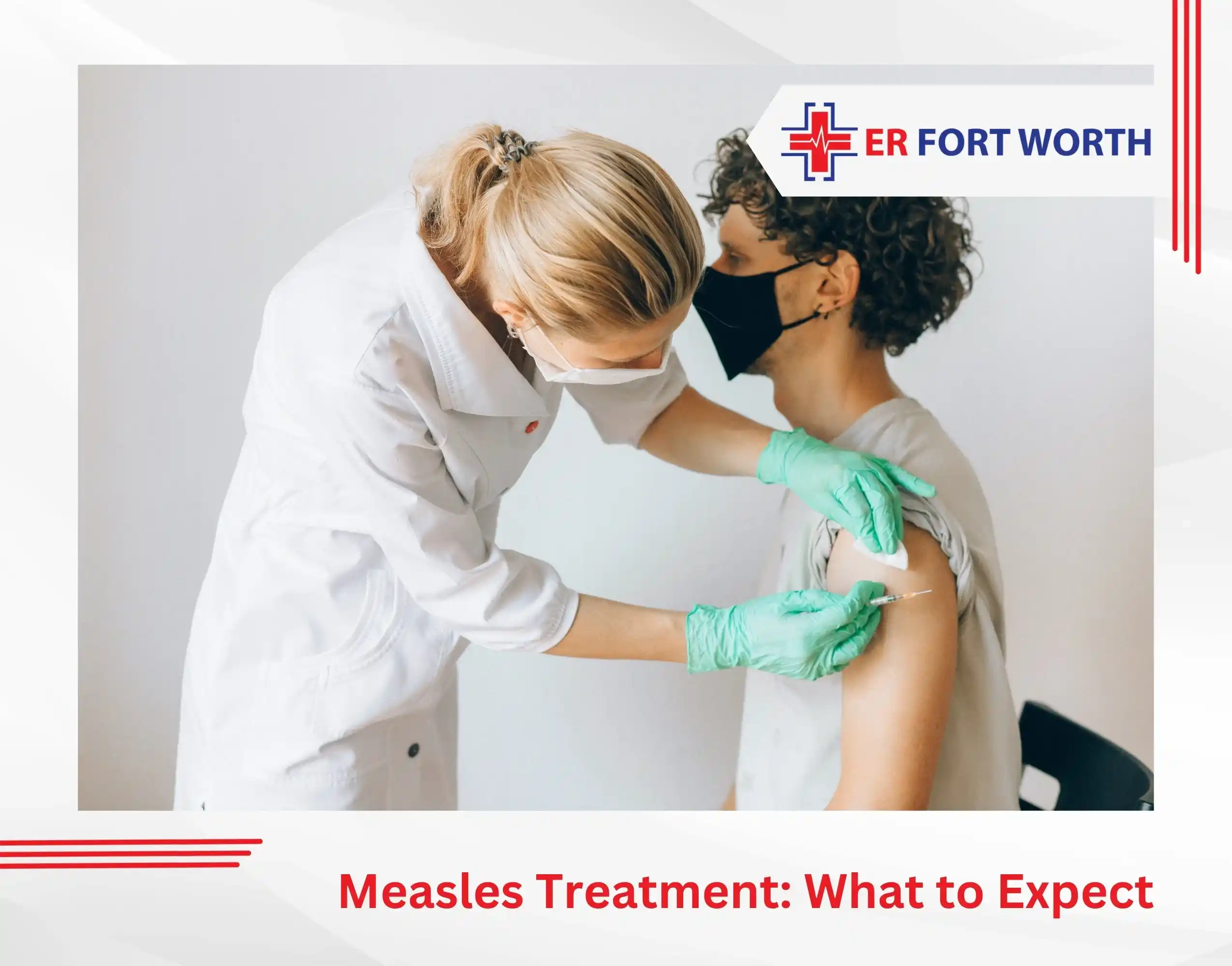 Measles Treatment What to Expect