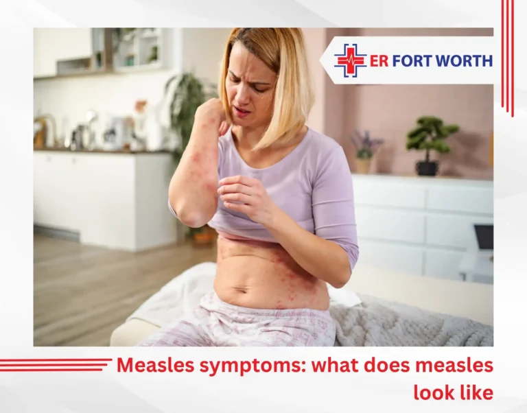 Measles symptoms what does measles look like