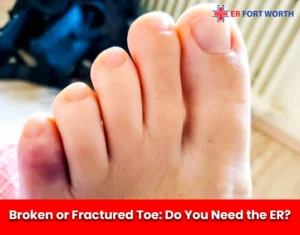 Broken or Fractured Toe Do You Need the ER