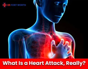 What Is a Heart Attack, Really
