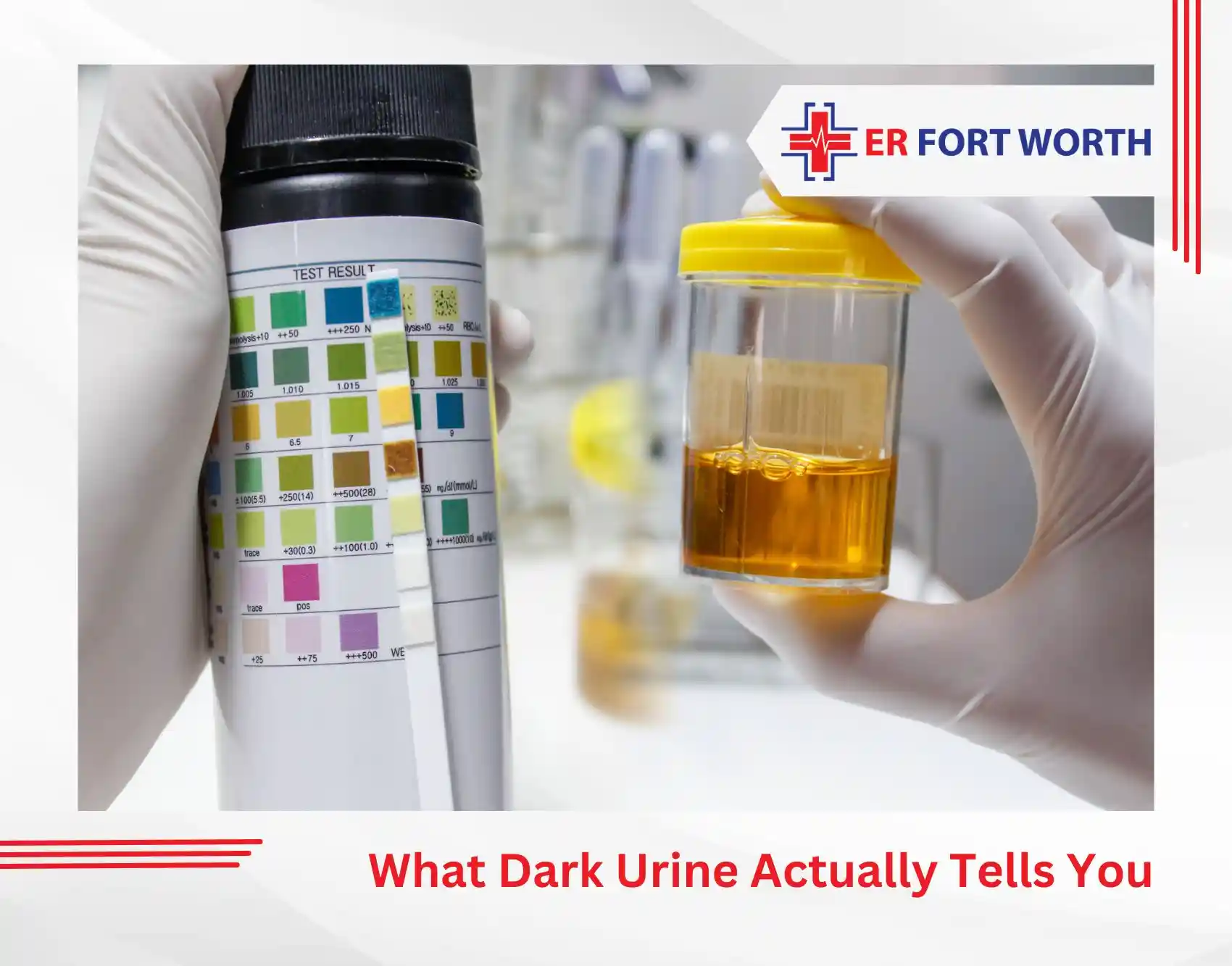 What Dark Urine Actually Tells You