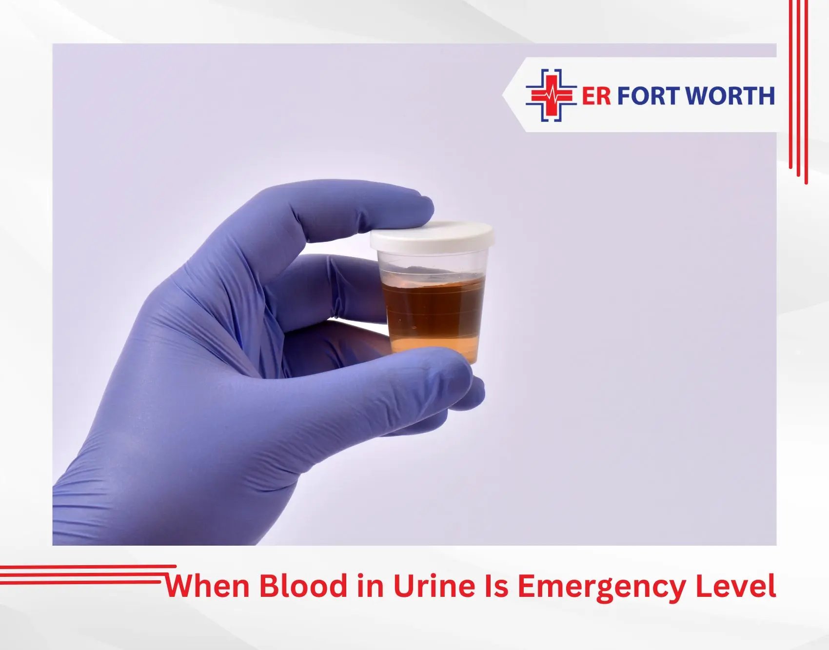 When Blood in Urine Is Emergency Level