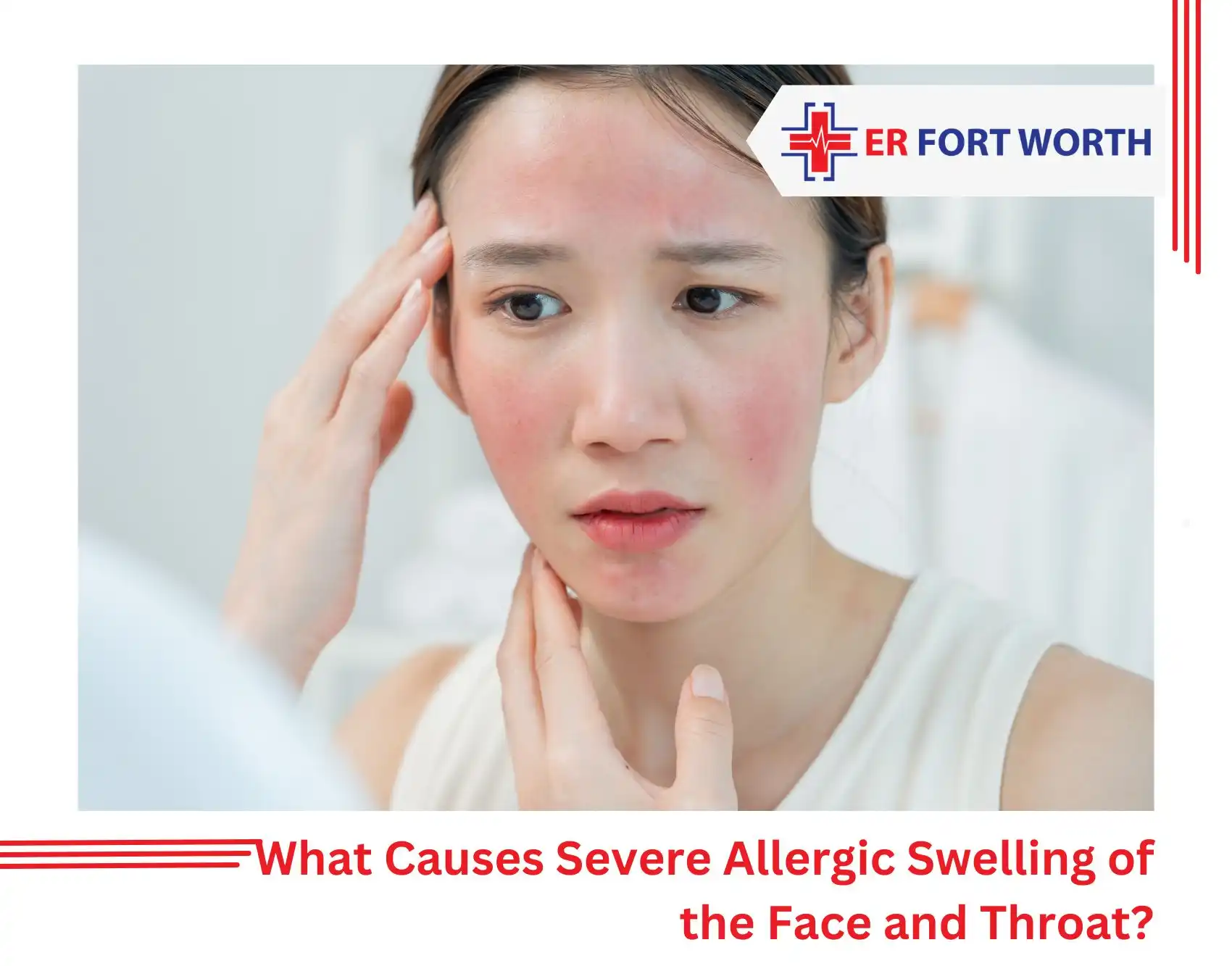 What Causes Severe Allergic Swelling of the Face and Throat