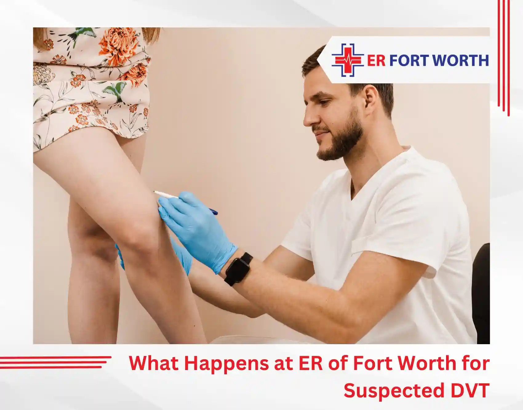 What Happens at ER of Fort Worth for Suspected DVT