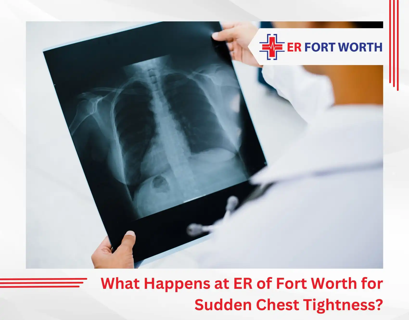 What Happens at ER of Fort Worth for Sudden Chest Tightness